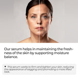 Argireline Serum, Matrixyl 3000 Serum with Hyaluronic Acid, Total Package Serum for Anti-Wrinkle, Collagen Boosting, Anti-Aging & Face Hydrating, Deep Wrinkle Repair & Firming for Fine Lines