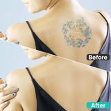 Tattoo-Cover-Up-Patch Sweatproof-And-Waterproof-Effective-Tattoo-Cover-Up-Tape Ultra-Thin-Invisible-Breathable-Patch-Concealer-Sticker-Suitable-For-Spot-And-Scar
