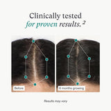 Nutrafol Women'S Hair Growth Supplements, Ages 18-44, Clinically Proven for Visibly Thicker and Stronger Hair, Dermatologist Recommended - 1 Month Supply