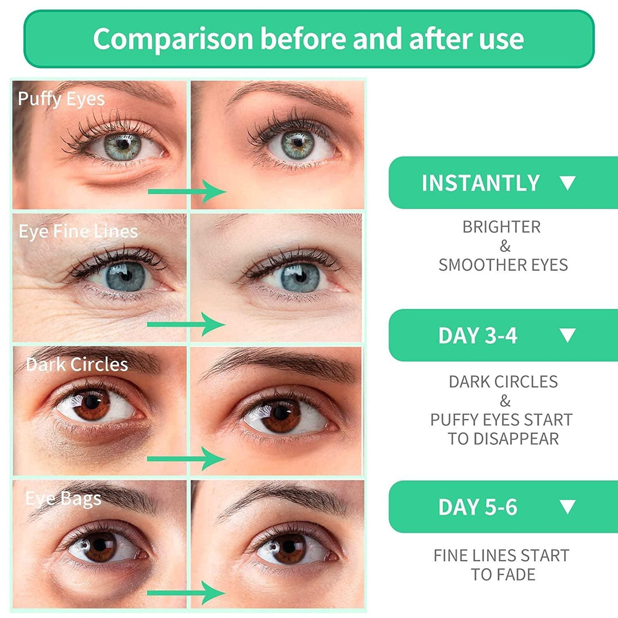 BREYLEE Aloe Vera Eye Mask– 60 Pcs - Puffy Eyes and Dark Circles Treatments – Look Younger and Reduce Wrinkles and Fine Lines Undereye, Improve and Firm Eye Skin - Pure Natural Material Extraction - Supply Center USA