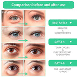 BREYLEE Aloe Vera Eye Mask– 60 Pcs - Puffy Eyes and Dark Circles Treatments – Look Younger and Reduce Wrinkles and Fine Lines Undereye, Improve and Firm Eye Skin - Pure Natural Material Extraction - Supply Center USA