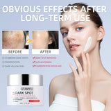 Dark Spot Remover Correcting Serum for Face: Dark Spot Remover for Age Spot Sun Spot Freckles Body Brown Spot Melasma Uneven Skin Tone- Faded Serum with Vitamin C for Women Daily Use
