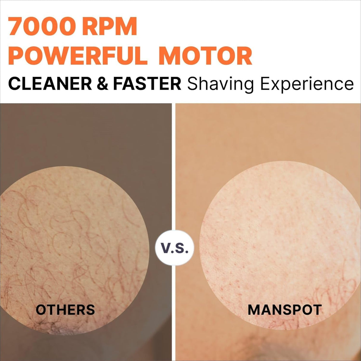 MANSPOT Manscape Groin & Body Hair Trimmer for Men, Electric Ball Trimmer Pubic Trimmer Shaver,Manscape Kit with 4 Guard,Replaceable Ceramic Blade Heads,Waterproof Wet/Dry Shaver,90 Minutes Shaving